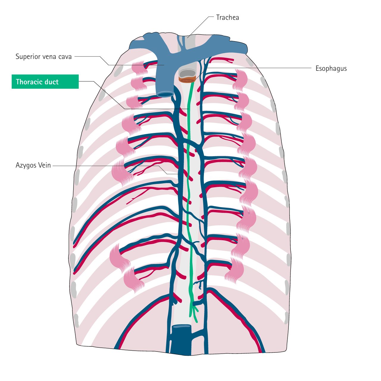Misplacement_Thoracic_duct