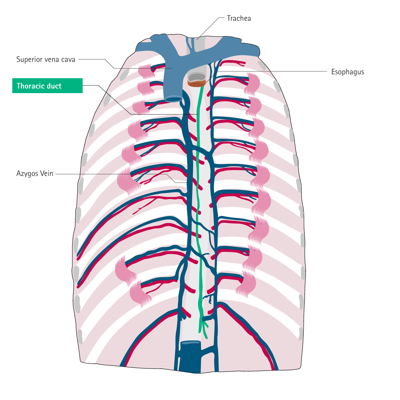 Misplacement_Thoracic_duct